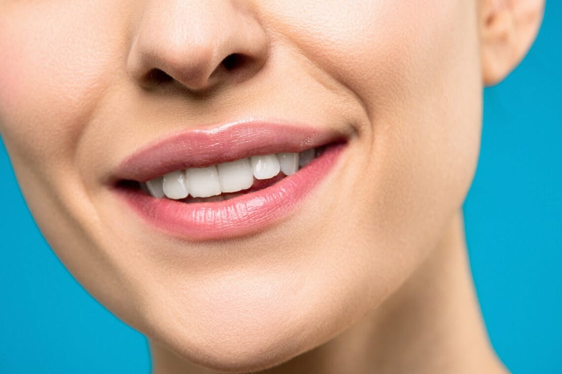 Sbiancamento dentale: scopri le migliori tecniche per un sorriso sano e luminoso