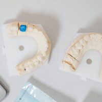 Perché scegliere materiali biocompatibili come la ceramica integrale, le resine composite, fibre di vetro e zirconia?